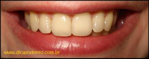 O Sorriso Dicas Odonto Dentista
