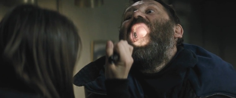 The thing Dicas Odonto Lars