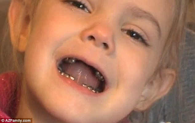 Menina dentes de metal 2