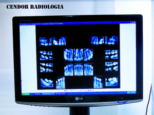 Cendor Radiologia 2