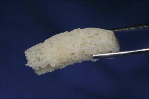 Enxerto banco de ossos