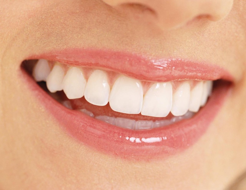 sorriso 3