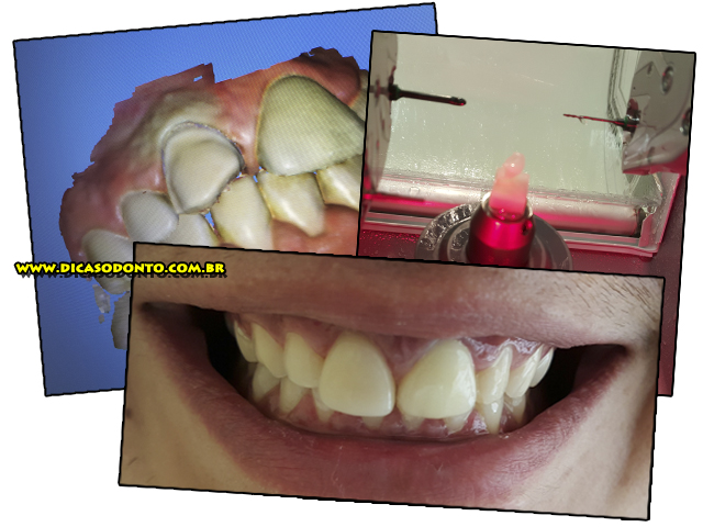 Dente 11 Dicas Odonto