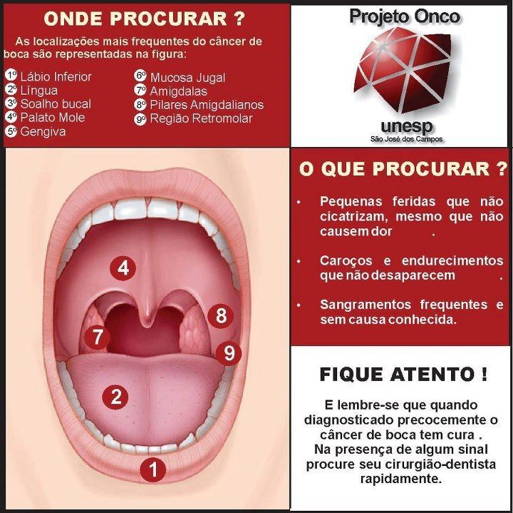 Câncer Bucal - Projeto Onco