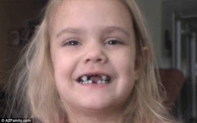 Menina dentes de metal 3